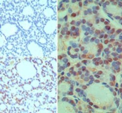 CUEDC2 Antibody, Novus Biologicals 0.025mg; Unlabeled:Antibodies, Polyclonal